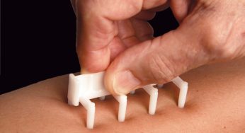 Global Allergy Diagnostics Market Research growing at a CAGR of 9.78% from 2017 to 2025