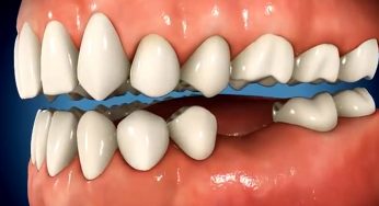 Global Restorative Dentistry Market growing at a CAGR of 6.1% from 2017 to 2025