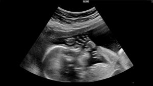 Global Ultrasound Market Variables, Information, Scope, Emerging Trends, Analysis And Forecasts 2025