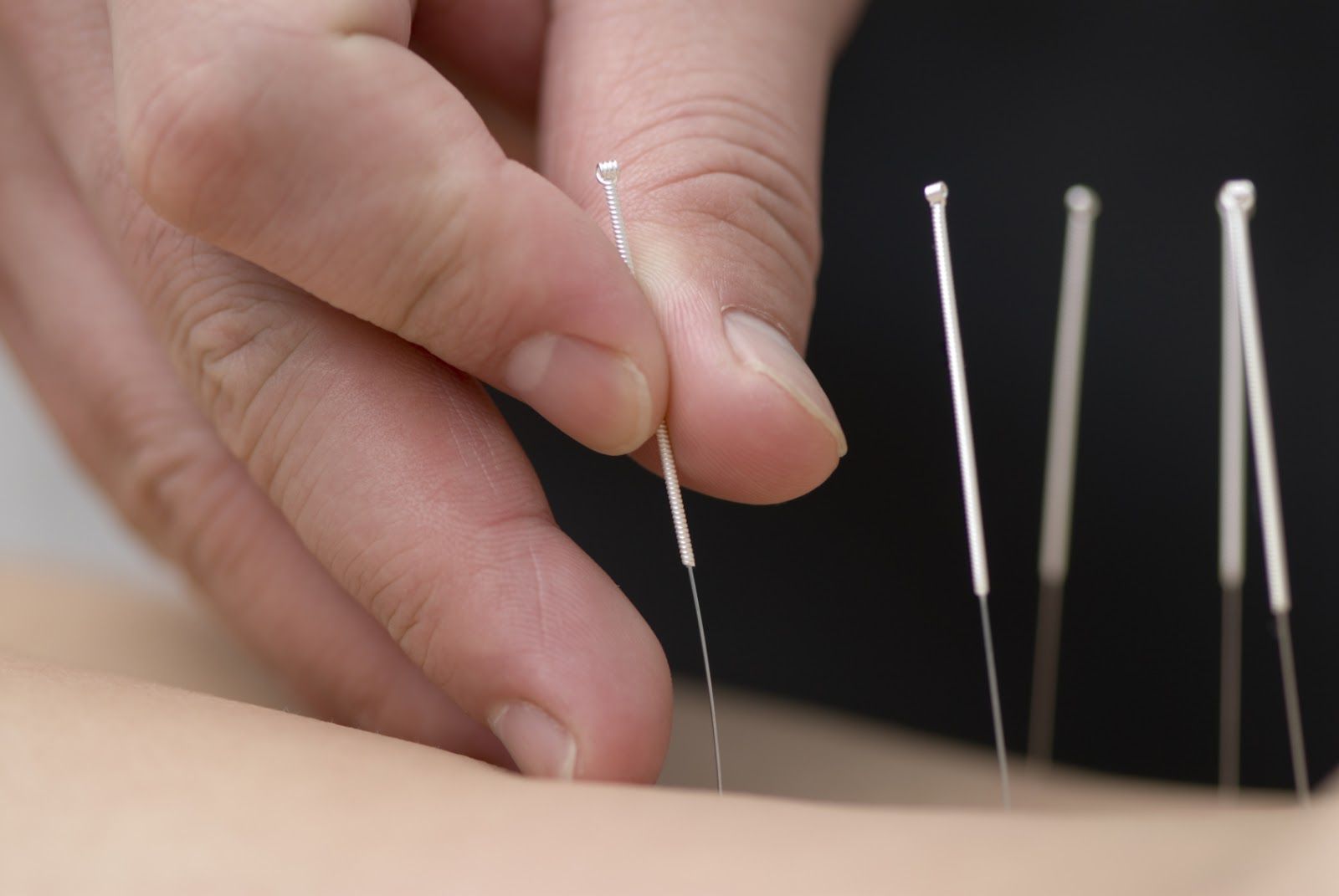 Global Acupuncture Needle Market Demand, Industry Research And End User Analysis, Outlook 2018 -2023<span class="rating-result after_title mr-filter rating-result-4157">			<span class="no-rating-results-text">No ratings yet.</span>		</span>