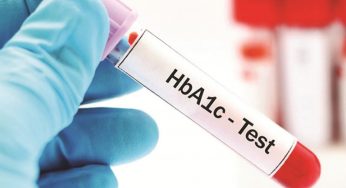 Global HbA1c Testing Device Market 2018 – Volume, Revenue And Growth Rate Forecast 2023