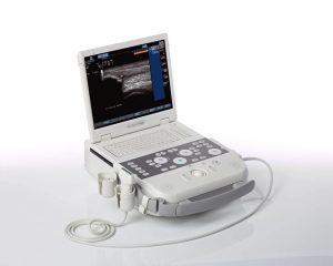 Global Medical Ultrasound Devices Market Growth, Share, Opportunities And Forecast By 2024 –  PMR