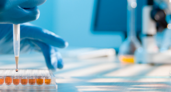 Global In Vitro Diagnostics Market Outlook By Product Overview, Application And Regions 2025