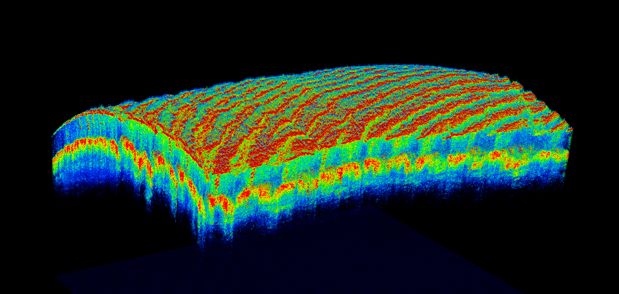 <span class="entry-title-primary">Optical Coherence Tomography Market Industry Size, Share, Development, Growth to 2025</span> <span class="entry-subtitle">Optical Coherence Tomography Market - 2019 to 2025</span><span class="rating-result after_title mr-filter rating-result-7458">			<span class="no-rating-results-text">No ratings yet.</span>		</span>