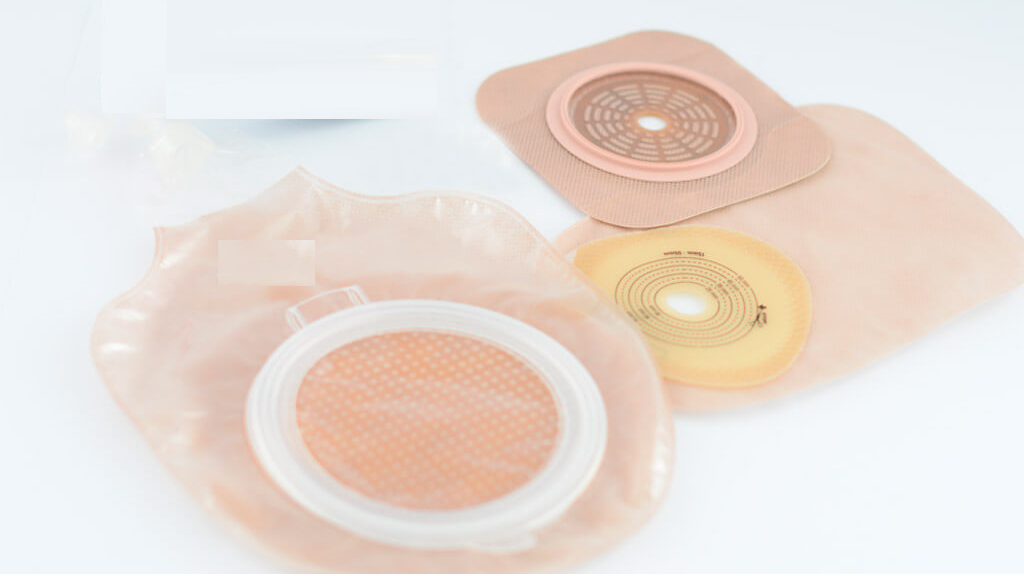 <span class="entry-title-primary">Global Stoma/Ostomy Care Market Outlook By Product Overview, Application And Regions 2025</span> <span class="entry-subtitle">Global Stoma/Ostomy Care Market Set For Rapid Growth And Trend 2019- 2025</span><span class="rating-result after_title mr-filter rating-result-6379">			<span class="no-rating-results-text">No ratings yet.</span>		</span>