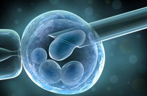 <span class="entry-title-primary">Stem Cell Therapy Market In-Depth Analysis of the Segmentation Which Comprises Product Type, Business Strategies, Development Factors- PMR</span> <span class="entry-subtitle">Stem Cell Therapy Market Scope and Market Expected – 2023</span>