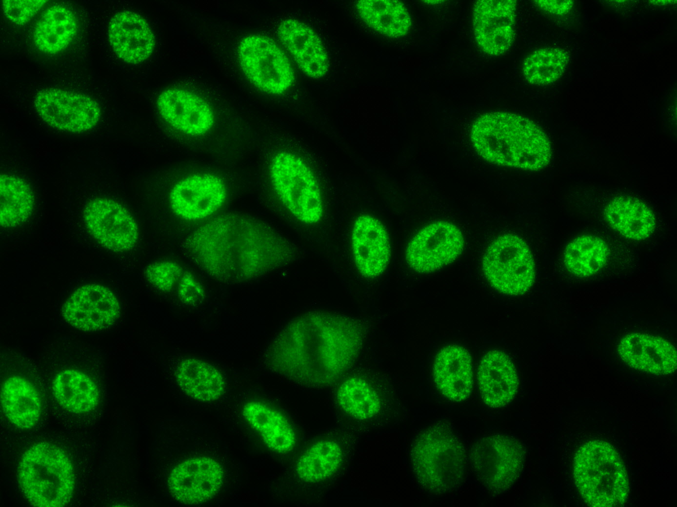 <span class="entry-title-primary">Antinuclear Antibody ANA Market by Manufacturers, Regions, Type and Application Forecast to 2025</span> <span class="entry-subtitle">Antinuclear Antibody ANA Test Market</span><span class="rating-result after_title mr-filter rating-result-12197">	<span class="mr-star-rating">			    <i class="fa fa-star mr-star-full"></i>	    	    <i class="fa fa-star mr-star-full"></i>	    	    <i class="fa fa-star mr-star-full"></i>	    	    <i class="fa fa-star mr-star-full"></i>	    	    <i class="fa fa-star mr-star-full"></i>	    </span><span class="star-result">	5/5</span>			<span class="count">				(1)			</span>			</span>