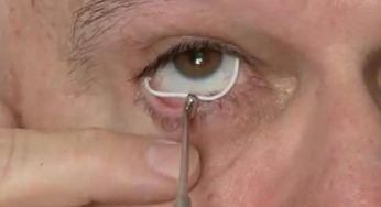 Glaucoma Treatment Devices – Industry Outlook and Growth by 2024