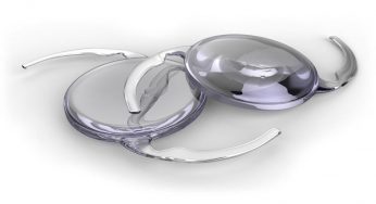 Intraocular Cataract Lenses Market Size, Industry Growth Analysis & Forecast: 2023