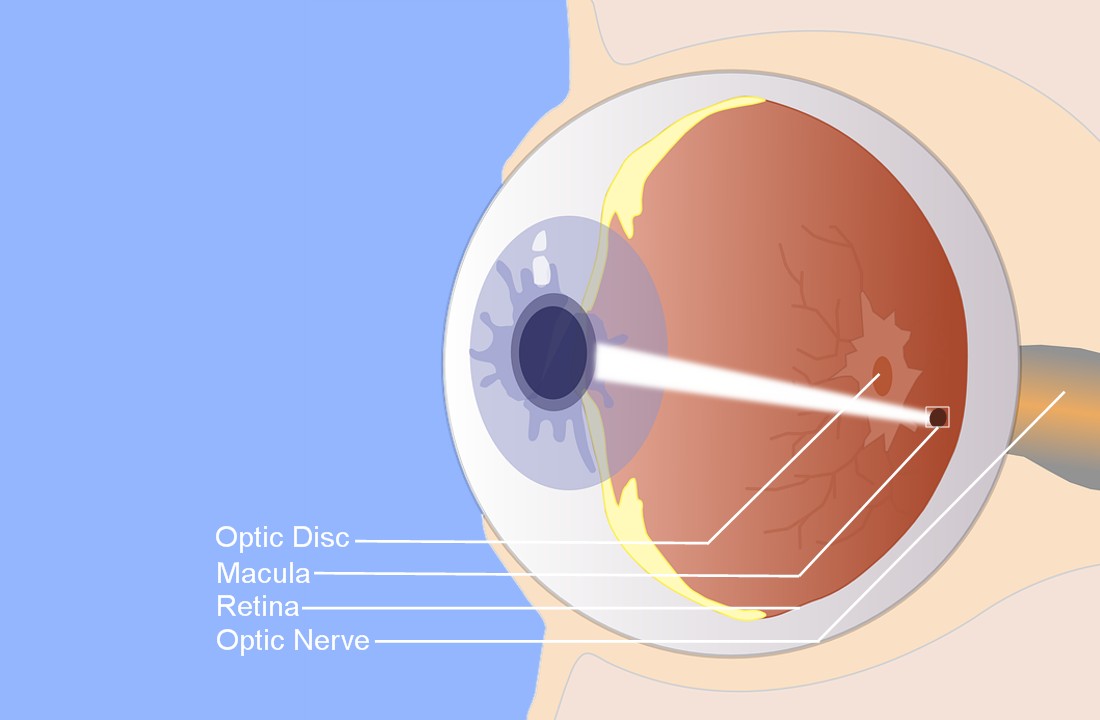 <span class="entry-title-primary">Juvenile Macular Degeneration Market is expected to grow at a CAGR of 6.56 % during the forecast period, 2017-2025</span> <span class="entry-subtitle">Juvenile Macular Degeneration Industry Report Analysis</span><span class="rating-result after_title mr-filter rating-result-12787">			<span class="no-rating-results-text">No ratings yet.</span>		</span>