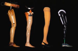 <span class="entry-title-primary">Lower Extremity Prostheses Market In-Depth Analysis of the Segmentation Which Comprises Product Type, Business Strategies, Development Factors</span> <span class="entry-subtitle">Lower Extremity Prostheses Industry Analysis and Forecast – 2025</span>