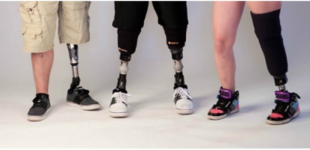 <span class="entry-title-primary">Lower Limb Prosthetics Market Factors, Growth Strategies, Drivers, Dynamics, Forecast and More – Planet Market Reports</span> <span class="entry-subtitle">Lower Limb Prosthetics Industry Analysis Report-2019</span><span class="rating-result after_title mr-filter rating-result-11325">	<span class="mr-star-rating">			    <i class="fa fa-star mr-star-full"></i>	    	    <i class="fa fa-star mr-star-full"></i>	    	    <i class="fa fa-star mr-star-full"></i>	    	    <i class="fa fa-star mr-star-full"></i>	    	    <i class="fa fa-star mr-star-full"></i>	    </span><span class="star-result">	5/5</span>			<span class="count">				(1)			</span>			</span>