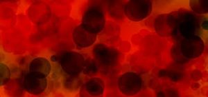 <span class="entry-title-primary">Plasma Protein Products Market 2019 – Industry Analysis, Size, Share, Strategies and Forecast To 2024</span> <span class="entry-subtitle">Plasma Protein Products Market Research Growth 2024</span>