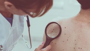 <span class="entry-title-primary">Melanoma Market Growth Factors, Applications, Regional Analysis, Key Players and Forecasts by 2025</span> <span class="entry-subtitle">Melanoma Market</span>