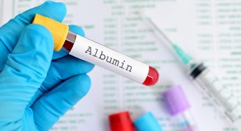 Albumin Market 2019 Global Leading Players, Industry Updates, Future Growth, Business Prospects, Forthcoming Developments and Future Investments by Forecast to 2025