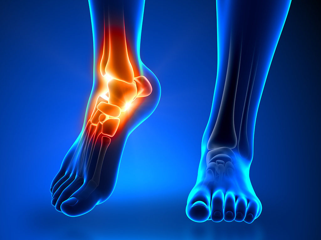 <span class="entry-title-primary">Ankle Replacement (arthroplasty) Market is Expected to Post a CAGR of close to 8.9% during the period 2019-2025</span> <span class="entry-subtitle">Ankle Replacement (arthroplasty) Industry Report Analysis</span><span class="rating-result after_title mr-filter rating-result-13854">	<span class="mr-star-rating">			    <i class="fa fa-star mr-star-full"></i>	    	    <i class="fa fa-star mr-star-full"></i>	    	    <i class="fa fa-star mr-star-full"></i>	    	    <i class="fa fa-star mr-star-full"></i>	    	    <i class="fa fa-star mr-star-full"></i>	    </span><span class="star-result">	5/5</span>			<span class="count">				(1)			</span>			</span>