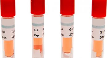 Biological Indicators Market 2019 : Top Companies, Application, Trends And Growth Factors And Development Forecast To 2024