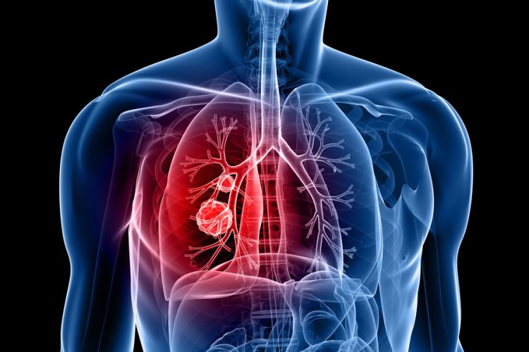 <span class="entry-title-primary">Breakthrough Therapy Designation Market Worth $145 Billion By 2025</span> <span class="entry-subtitle">Breakthrough Therapy Designation Industry Report Analysis</span><span class="rating-result after_title mr-filter rating-result-15759">	<span class="mr-star-rating">			    <i class="fa fa-star mr-star-full"></i>	    	    <i class="fa fa-star mr-star-full"></i>	    	    <i class="fa fa-star mr-star-full"></i>	    	    <i class="fa fa-star mr-star-full"></i>	    	    <i class="fa fa-star mr-star-full"></i>	    </span><span class="star-result">	5/5</span>			<span class="count">				(2)			</span>			</span>