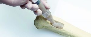 <span class="entry-title-primary">Injectable Bone Graft Drug Market – Current and Upcoming Trends in 2018 – 2025</span> <span class="entry-subtitle">Injectable Bone Graft Industry Report</span>