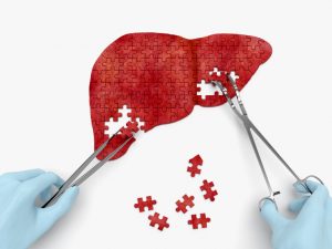 <span class="entry-title-primary">Global Liver Biopsy Market 2019-2024 Growth, Trends and Demands Research Report</span> <span class="entry-subtitle">Global Liver Biopsy Market Research analysis and Forecast </span>