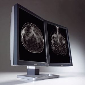 <span class="entry-title-primary">Medical Display Market 2019 Size, Industry Status and Forecast, Competition Landscape and Growth Opportunity</span> <span class="entry-subtitle">Medical Display Industry is Expected to Witness the Fastest Growth</span>