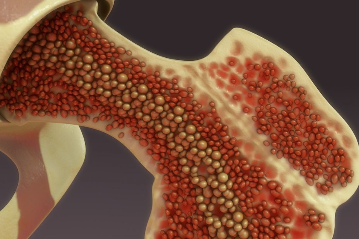 <span class="entry-title-primary">Myelodysplastic Syndrome Drugs Market Size, Share & Trends Analysis By Therapeutic Class, And Segment Forecasts, 2019 – 2025</span> <span class="entry-subtitle">Myelodysplastic Syndrome Market  Size Is Expected To Reach USD 2.38 Billion By 2025</span><span class="rating-result after_title mr-filter rating-result-15771">	<span class="mr-star-rating">			    <i class="fa fa-star mr-star-full"></i>	    	    <i class="fa fa-star mr-star-full"></i>	    	    <i class="fa fa-star mr-star-full"></i>	    	    <i class="fa fa-star mr-star-full"></i>	    	    <i class="fa fa-star mr-star-full"></i>	    </span><span class="star-result">	5/5</span>			<span class="count">				(1)			</span>			</span>