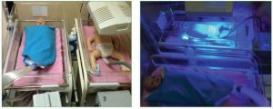 <span class="entry-title-primary">Neonatal Phototherapy Devices Market: Global Key Players, Trends, Share, Industry Size, Growth, Opportunities, Forecast To 2024</span> <span class="entry-subtitle">Neonatal Phototherapy Devices Industry Forecast</span>