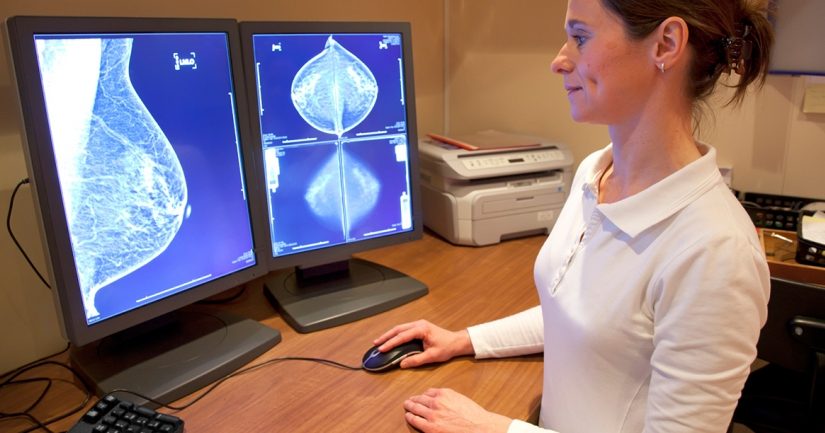 <span class="entry-title-primary">Breast Imaging Market, Industry Analysis, Size, Share, Research, Development and Forecast to 2024</span> <span class="entry-subtitle">Breast Imaging Market Research Reports:</span><span class="rating-result after_title mr-filter rating-result-16607">	<span class="mr-star-rating">			    <i class="fa fa-star mr-star-full"></i>	    	    <i class="fa fa-star mr-star-full"></i>	    	    <i class="fa fa-star mr-star-full"></i>	    	    <i class="fa fa-star mr-star-full"></i>	    	    <i class="fa fa-star mr-star-full"></i>	    </span><span class="star-result">	5/5</span>			<span class="count">				(1)			</span>			</span>