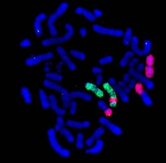 Chromosome Enumeration Probes CEP Market Growth, Analysis of Key Players and Trends<span class="rating-result after_title mr-filter rating-result-16326">	<span class="mr-star-rating">			    <i class="fa fa-star mr-star-full"></i>	    	    <i class="fa fa-star mr-star-full"></i>	    	    <i class="fa fa-star mr-star-full"></i>	    	    <i class="fa fa-star mr-star-full"></i>	    	    <i class="fa fa-star mr-star-full"></i>	    </span><span class="star-result">	5/5</span>			<span class="count">				(1)			</span>			</span>