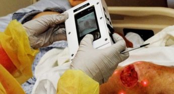 Digital Wound Measurement Devices Market to See Strong Growth And Market Scope In Upcoming Years