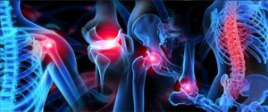 <span class="entry-title-primary">Musculoskeletal Pain Market 2019 Global Industry Analysis, by Size, Share, Growth, Trends, Top Companies Profiles, and Forecast Until 2028</span> <span class="entry-subtitle">Global Musculoskeletal Pain Market</span>