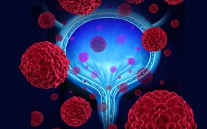 Nivolumab market forecast to 2024 explored in latest research