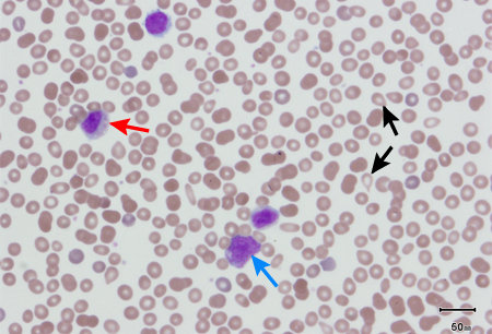 <span class="entry-title-primary">Primary Myelofibrosis Market, Share, Growth, Trends and Forecast to 2025: Market Study Report</span> <span class="entry-subtitle">Primary Myelofibrosis Market Report Summary</span><span class="rating-result after_title mr-filter rating-result-20645">	<span class="mr-star-rating">			    <i class="fa fa-star mr-star-full"></i>	    	    <i class="fa fa-star mr-star-full"></i>	    	    <i class="fa fa-star mr-star-full"></i>	    	    <i class="fa fa-star mr-star-full"></i>	    	    <i class="fa fa-star mr-star-full"></i>	    </span><span class="star-result">	5/5</span>			<span class="count">				(1)			</span>			</span>