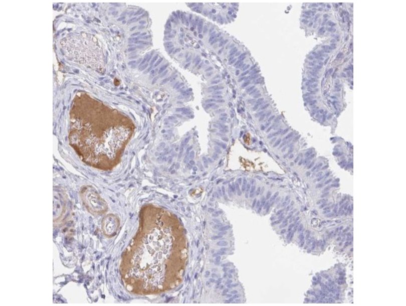 <span class="entry-title-primary">TSG6 Antibody Market Share, Size, Trends, Demand, Key Players and Forecast to 2025</span> <span class="entry-subtitle">Global TSG6 Antibody Market Research</span><span class="rating-result after_title mr-filter rating-result-17611">	<span class="mr-star-rating">			    <i class="fa fa-star mr-star-full"></i>	    	    <i class="fa fa-star mr-star-full"></i>	    	    <i class="fa fa-star mr-star-full"></i>	    	    <i class="fa fa-star mr-star-full"></i>	    	    <i class="fa fa-star mr-star-full"></i>	    </span><span class="star-result">	5/5</span>			<span class="count">				(1)			</span>			</span>