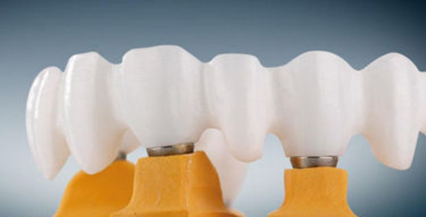 <span class="entry-title-primary">Zirconia Dental Material Market Growth Rate, Demands, Status and Application Forecast to 2025</span> <span class="entry-subtitle">Zirconia Dental Material Market Research</span><span class="rating-result after_title mr-filter rating-result-17069">	<span class="mr-star-rating">			    <i class="fa fa-star mr-star-full"></i>	    	    <i class="fa fa-star mr-star-full"></i>	    	    <i class="fa fa-star mr-star-full"></i>	    	    <i class="fa fa-star mr-star-full"></i>	    	    <i class="fa fa-star mr-star-full"></i>	    </span><span class="star-result">	5/5</span>			<span class="count">				(1)			</span>			</span>