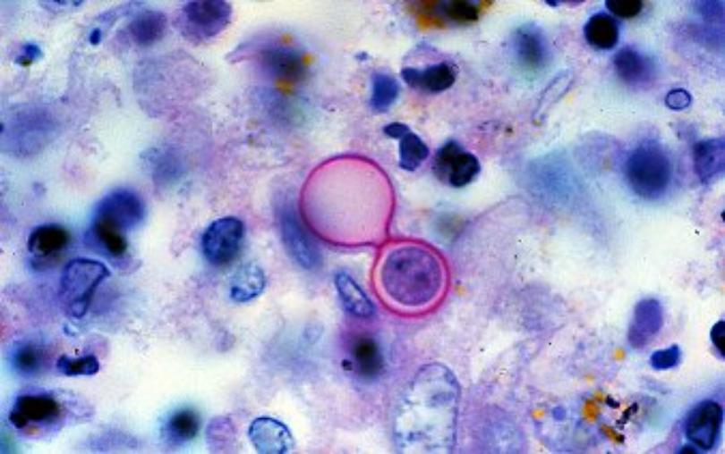 <span class="entry-title-primary">Blastomycosis Global Market 2019 Trend, Segmentation And Forecast To 2019 to 2028</span> <span class="entry-subtitle">Blastomycosis Product Profiles, Analysis And Forecast</span><span class="rating-result after_title mr-filter rating-result-22190">	<span class="mr-star-rating">			    <i class="fa fa-star mr-star-full"></i>	    	    <i class="fa fa-star mr-star-full"></i>	    	    <i class="fa fa-star mr-star-full"></i>	    	    <i class="fa fa-star mr-star-full"></i>	    	    <i class="fa fa-star mr-star-full"></i>	    </span><span class="star-result">	5/5</span>			<span class="count">				(1)			</span>			</span>