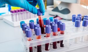 <span class="entry-title-primary">Global Blood Culture Test Market Is Expected to Reach 3740 Million USD with a CAGR of 15.8% During Period 2019-2019</span> <span class="entry-subtitle">Global Blood Culture Test Market Overview:</span>