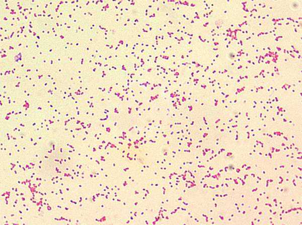 <span class="entry-title-primary">Global Brucella Infection Market Size and Share: Industry Forecast to 2028</span> <span class="entry-subtitle">Global Brucella Infection Market Report Summary</span><span class="rating-result after_title mr-filter rating-result-21652">	<span class="mr-star-rating">			    <i class="fa fa-star mr-star-full"></i>	    	    <i class="fa fa-star mr-star-full"></i>	    	    <i class="fa fa-star mr-star-full"></i>	    	    <i class="fa fa-star mr-star-full"></i>	    	    <i class="fa fa-star mr-star-full"></i>	    </span><span class="star-result">	5/5</span>			<span class="count">				(1)			</span>			</span>