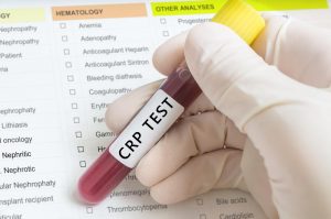 C-Reactive Protein Testing Market Size, Growth, Trends Forecast 2019-2025