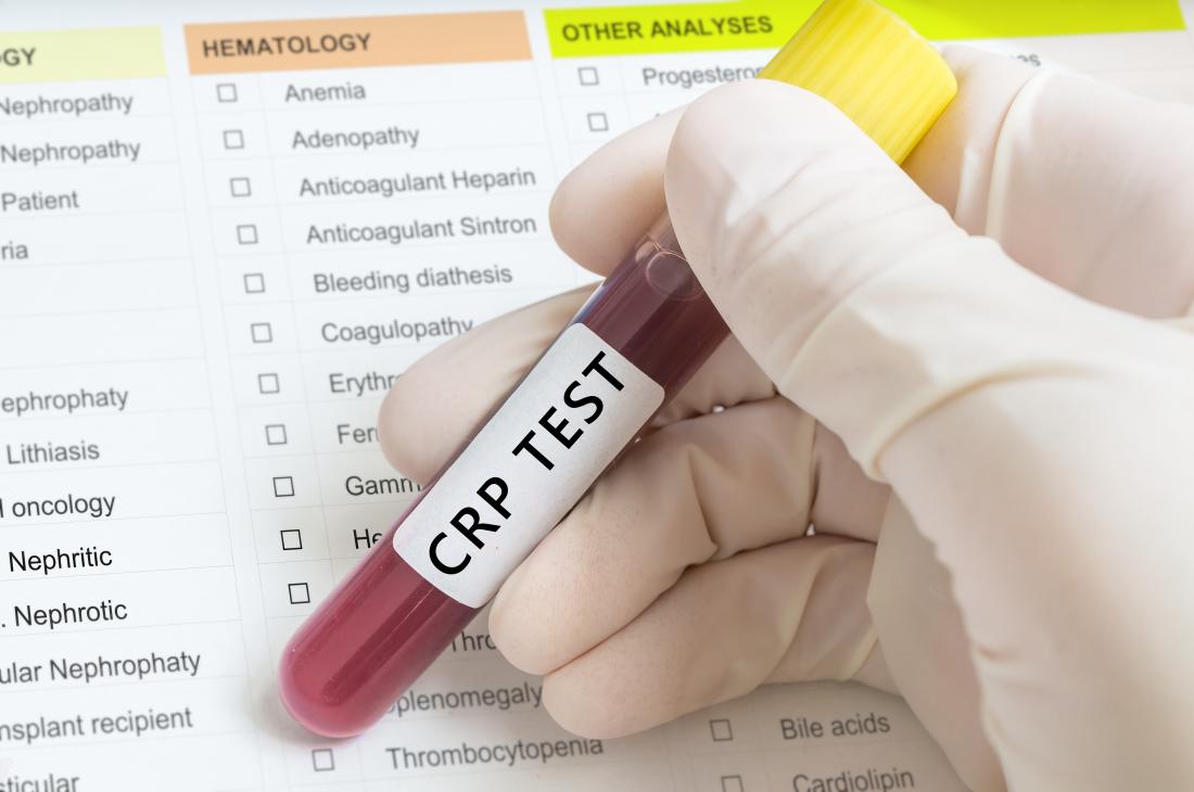 C-Reactive Protein Testing Market Size, Growth, Trends Forecast 2019-2025<span class="rating-result after_title mr-filter rating-result-26411">			<span class="no-rating-results-text">No ratings yet.</span>		</span>