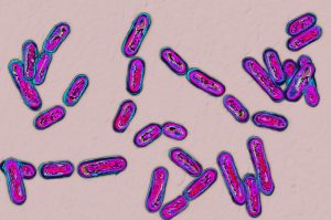 <span class="entry-title-primary">Global C diff Infection Market Size and Share 2028 Sales, Production, Consumption and Segmentation</span> <span class="entry-subtitle">Global C diff Infection Market Report Summary</span>