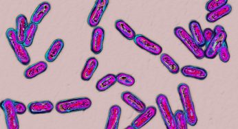 Global C diff Infection Market Size and Share 2028 Sales, Production, Consumption and Segmentation