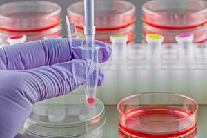 <span class="entry-title-primary">Cell Culture Equipment Market Trends, Drivers, Strategies, Applications and Competitive Landscape 2025</span> <span class="entry-subtitle">Global Cell Culture Equipment Market Growth</span>