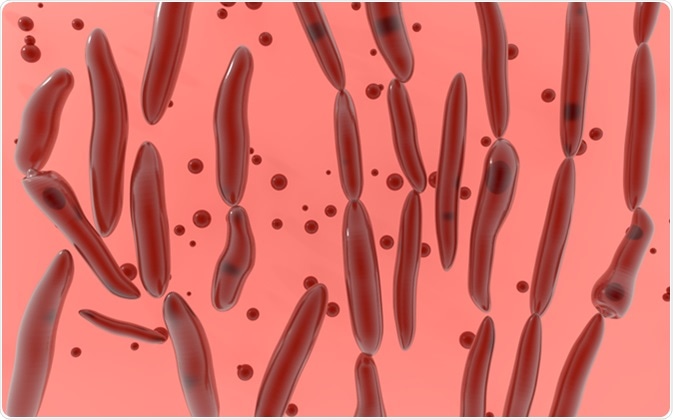 <span class="entry-title-primary">Global Clostridium botulinum Infection Market Share, Distributor Analysis and Development Trends 2028</span> <span class="entry-subtitle">Global Clostridium botulinum Infection Market</span><span class="rating-result after_title mr-filter rating-result-21163">	<span class="mr-star-rating">			    <i class="fa fa-star mr-star-full"></i>	    	    <i class="fa fa-star mr-star-full"></i>	    	    <i class="fa fa-star mr-star-full"></i>	    	    <i class="fa fa-star mr-star-full"></i>	    	    <i class="fa fa-star mr-star-full"></i>	    </span><span class="star-result">	5/5</span>			<span class="count">				(1)			</span>			</span>