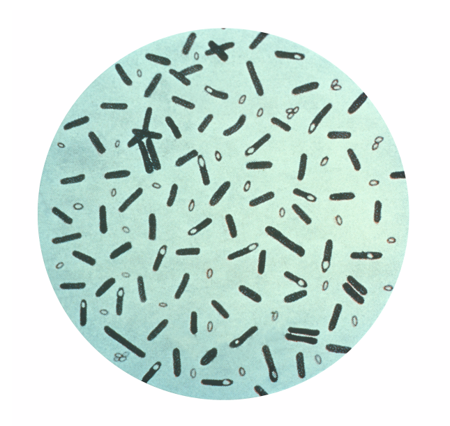 <span class="entry-title-primary">Clostridium perfringens infection Market Analysis, Size, Growth, Trends, Price and Manufacturers Forecast 2019 – 2028</span> <span class="entry-subtitle">Global Clostridium perfringens infection Market</span><span class="rating-result after_title mr-filter rating-result-21171">	<span class="mr-star-rating">			    <i class="fa fa-star mr-star-full"></i>	    	    <i class="fa fa-star mr-star-full"></i>	    	    <i class="fa fa-star mr-star-full"></i>	    	    <i class="fa fa-star mr-star-full"></i>	    	    <i class="fa fa-star mr-star-full"></i>	    </span><span class="star-result">	5/5</span>			<span class="count">				(1)			</span>			</span>