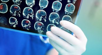 Research focused on the Contrast Agent market forecast to 2024