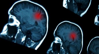 Contrast Agents Market Analysis 2019 (By Segment, Key Players and Applications) And Forecasts to 2025