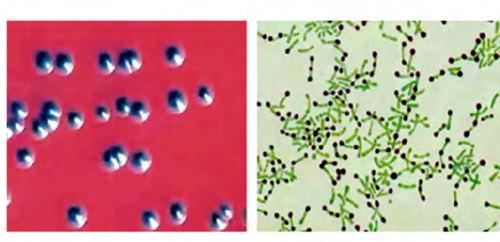 <span class="entry-title-primary">Corynebacterium diphtheriae Infection Market by Trends, Key Players, Driver, Segmentation, Forecast to 2028</span> <span class="entry-subtitle">Global Corynebacterium diphtheriae Infection Market</span><span class="rating-result after_title mr-filter rating-result-21220">	<span class="mr-star-rating">			    <i class="fa fa-star mr-star-full"></i>	    	    <i class="fa fa-star mr-star-full"></i>	    	    <i class="fa fa-star mr-star-full"></i>	    	    <i class="fa fa-star mr-star-full"></i>	    	    <i class="fa fa-star mr-star-full"></i>	    </span><span class="star-result">	5/5</span>			<span class="count">				(1)			</span>			</span>