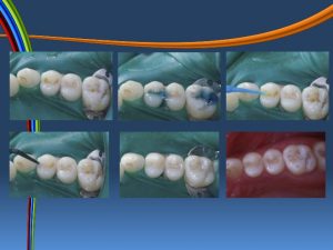 <span class="entry-title-primary">Dental Composite Resins Market: 2019 Global Industry Trends, Growth,Size and 2025 Forecast Research</span> <span class="entry-subtitle">Global Dental Composite Resins Market</span>