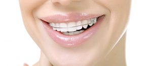 <span class="entry-title-primary">Dental Retainers Market Size, Share, Growth, Trend and Forecast – 2025</span> <span class="entry-subtitle">Global Dental Retainers Market Research:</span>